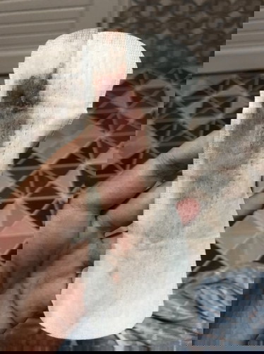 ท้องได้ 34+2 มีเลือดไหล