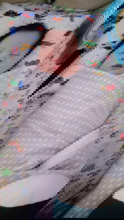 Bayi 1 Minggu bisa miring