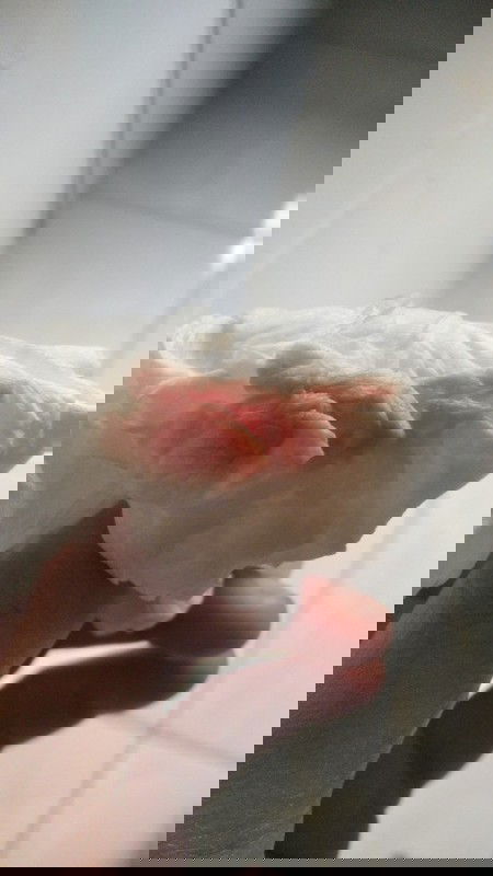 KELUAR FLEK, PADAHAL 1 HARI SEBELUM BARU USG DAN DI NYATAKAN SEHAT.