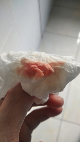 KELUAR FLEK, PADAHAL 1 HARI SEBELUM BARU USG DAN DI NYATAKAN SEHAT.