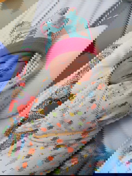 Bahayakah Bayi kuning?