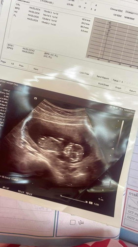 ครรภ์14สัปดาห์ ท้องเล็กมาก ท้องแรกค่ะ