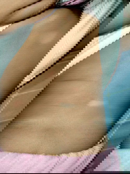 White spot on my baby's skin