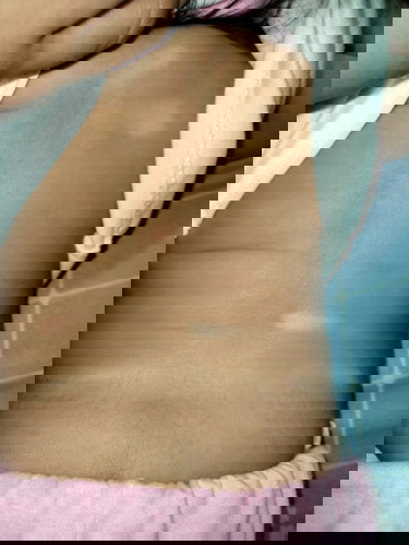 White spot on my baby's skin