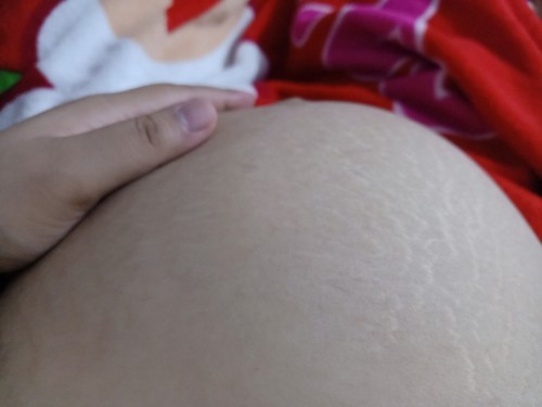 เจ็บปวดเชิงกราน