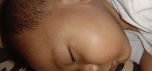 Bercak putih