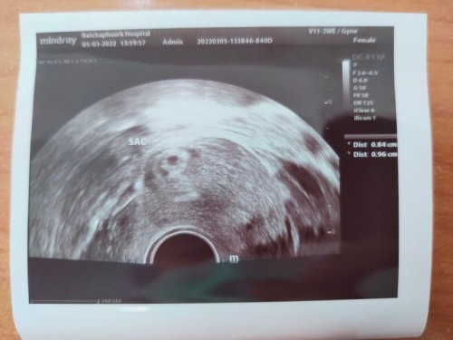 แม่ๆ เจอตัวน้องตอนกี่W กันคะมาแชร์กัน