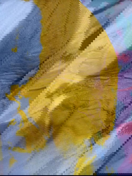 Fases bayi encer usia 2 bulan 9 hari