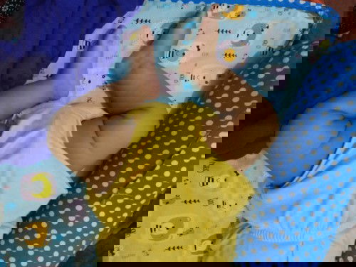 Bentuk kaki bayi usia 3bln