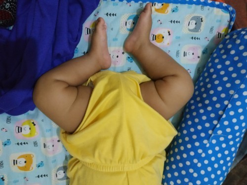 Bentuk kaki bayi usia 3bln