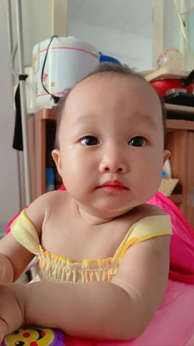 ติดเต้าไม่ยอมดูดขวดนม