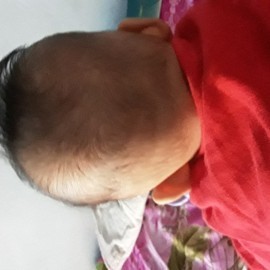 Bunda gmn ea ngembali n jdi bundar kepala baby q usia 6 bln kepalanya datar