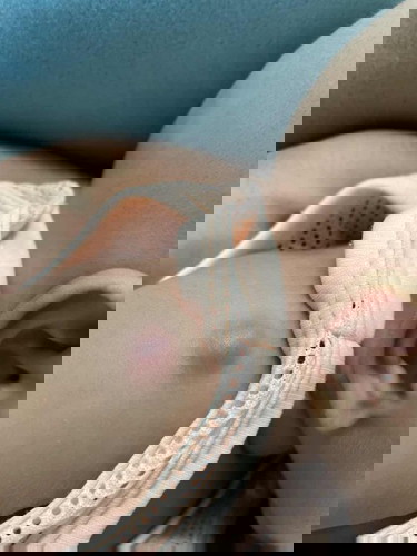 เรียกว่า ปลูกฝีหรือป่าวคะ