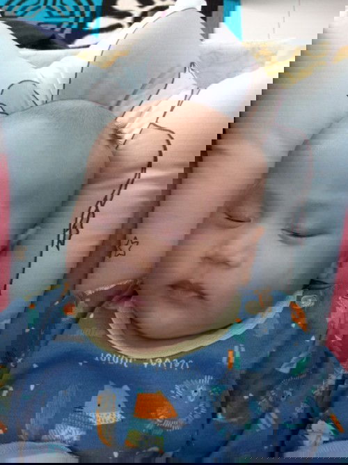 Bercak putih di Pipi