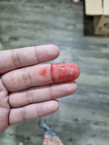 Blood at 33 weeks