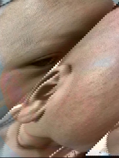 Pipi bayi merah kasar kering