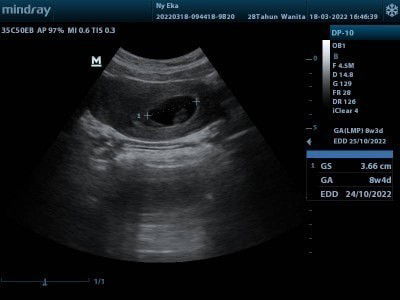 Rencana Allah lebih baik