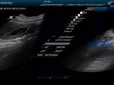 Rencana Allah lebih baik