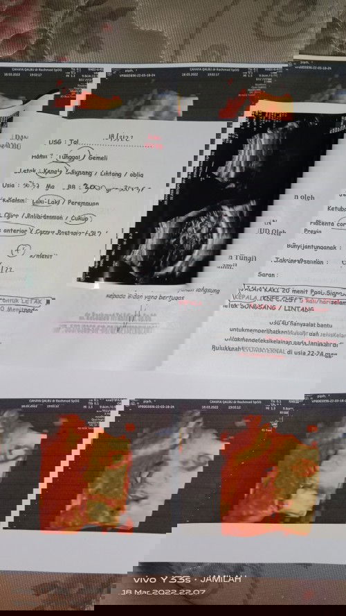 tanya donk bund 😇