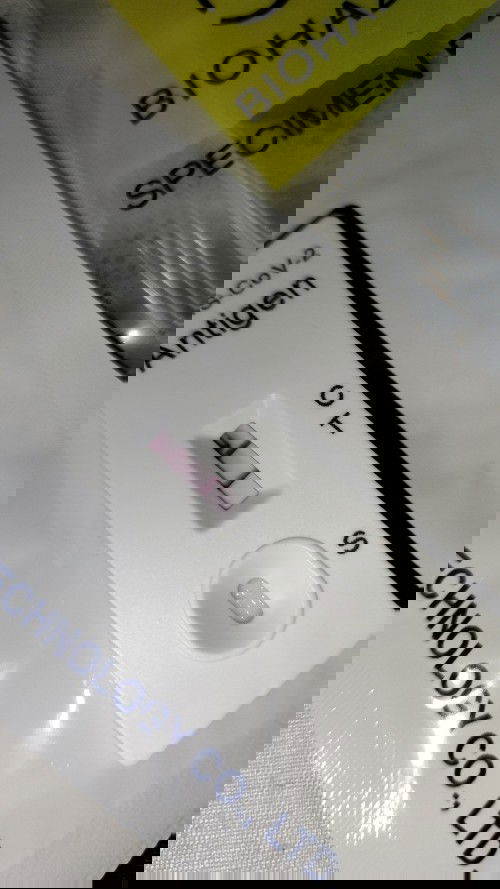 Covid in 20weeks pregnancy