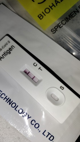 Covid in 20weeks pregnancy