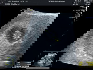 หนูน้อยของแม่👶