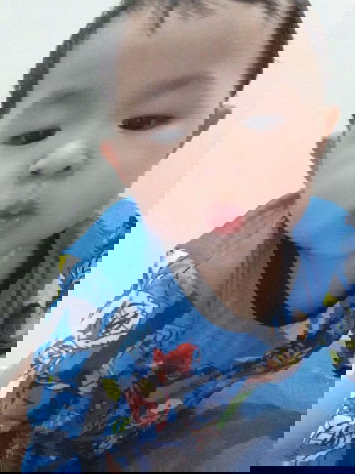 ก้อนที่ท้ายทอย