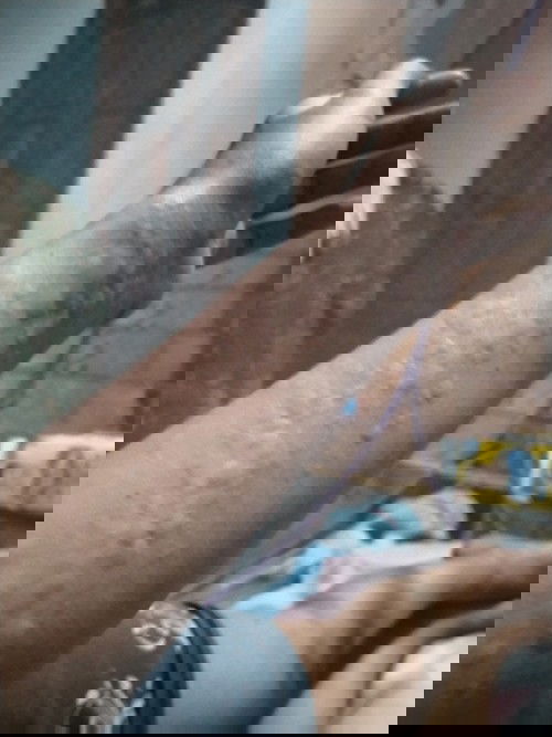 Gatal gatal trimester ketiga