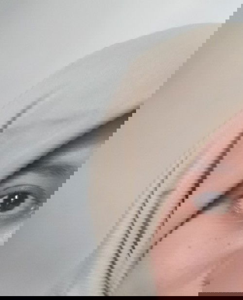 Keluar jerawat & tai lalat saat hamil