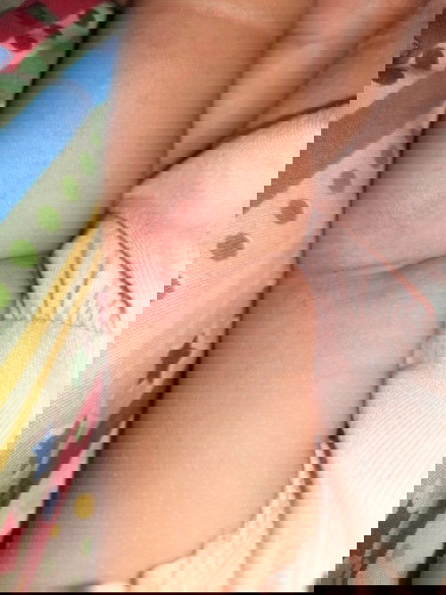 Kulit bayi sensitif-an