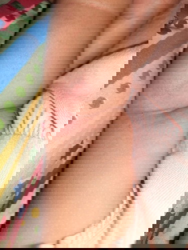 Kulit bayi sensitif-an