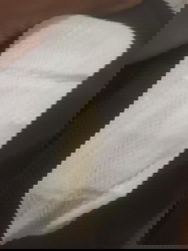 7 เดือน ปวดช่วงล่าง