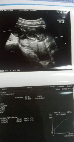 อยากรู้ว่า ช หรือ ญ