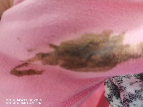 Kesan pada sluar dlm