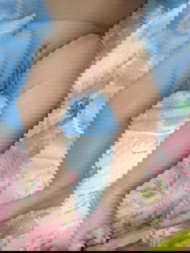 ขาโก่ง ต้องทำยังไงคะ ใช้รองเท้าดัดขาได้ไหมคะ