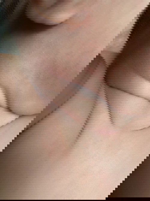 ลูกน้อยเป็นผื่น