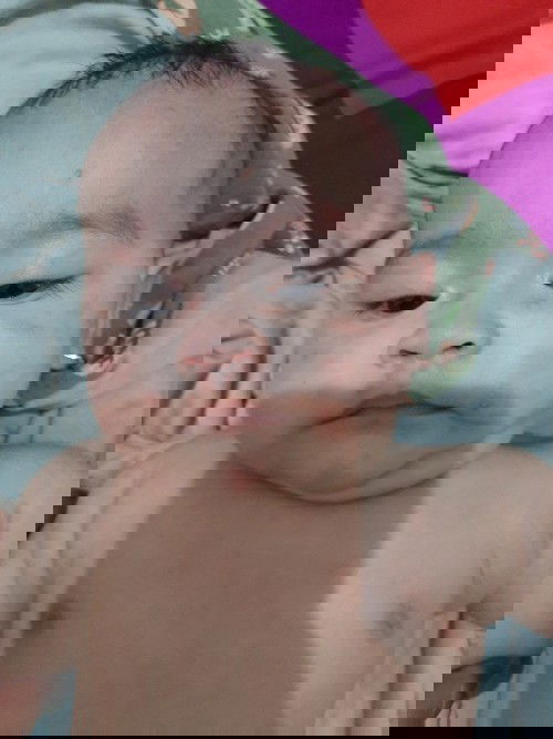 Muka baby 4 bulan merah