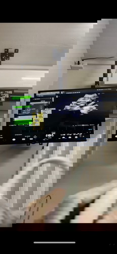 ได้ทีมลูกสาวว