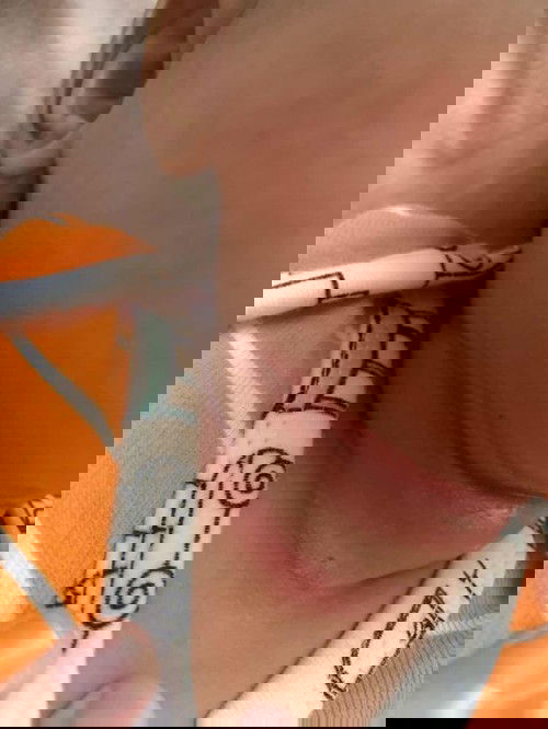 Hi mommies nak tanya normal ke leher anak jadi merah macam ni? Ada cara tak nak hilangkan merah2 ni?