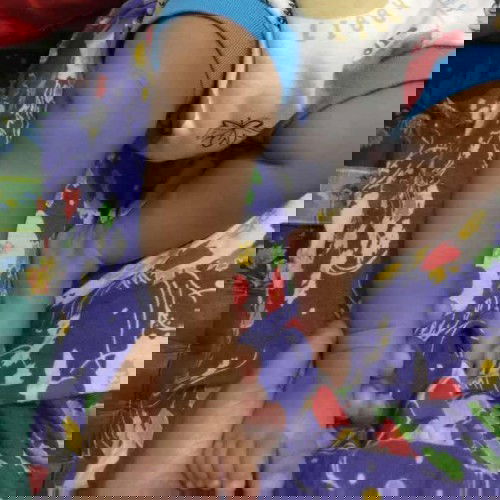 Kaki terlihat bengkok