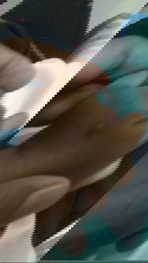 Cacar air bayi usia 7bulan 12 hari