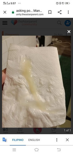 MUCUS PLUG