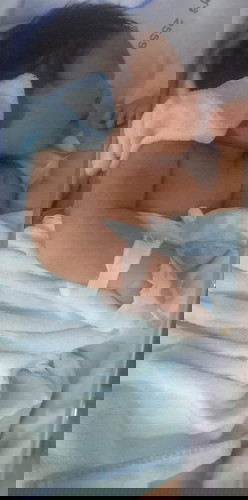 เป็นไข้หลังได้รับวัคซีนป้องกันวัณโรค