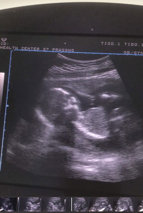 #ทีมสิงหาคม 65