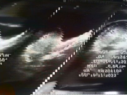 Hamil 5w3d ngeflek bun :( smoga anaku baik" sajaa