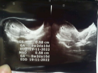 Hamil 5w3d ngeflek bun :( smoga anaku baik" sajaa