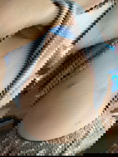 น้องมีรอยช้ำที่หน้าอก