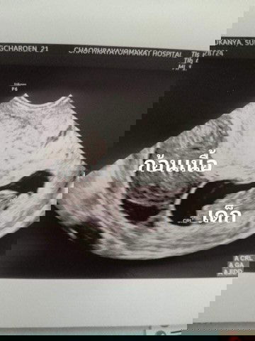 แม่ท่านไหนเคยเจอเหตุการณ์แบบนี้บ้างคะ