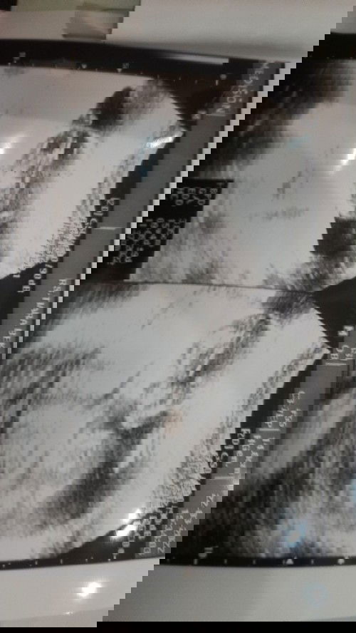 Kehamilan 16 minggu, berat badan bayi seharus nya di atas 150 gr, tp berat bayi saya 137 gr