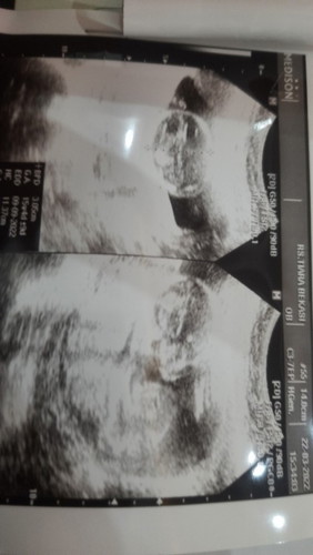 Kehamilan 16 minggu, berat badan bayi seharus nya di atas 150 gr, tp berat bayi saya 137 gr